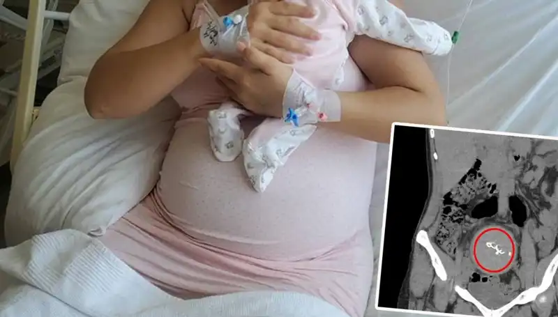 Doğumda Unutulmuş Gazlı Bez Skandalı: Soruşturma Başlatıldı