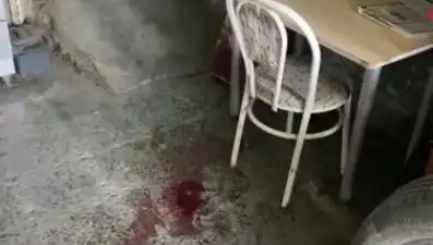 Sandalyeden Düşen Adam, Ağır Yaralandı: Kazanın Nedeni Ne?