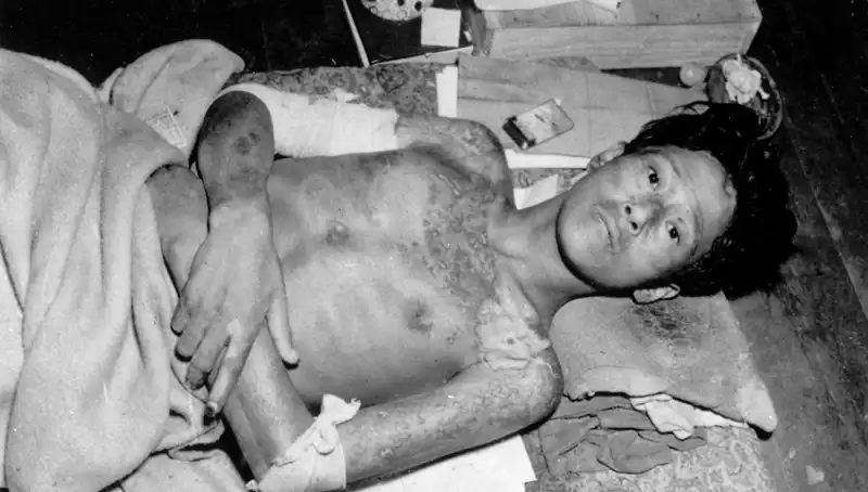 Nagasaki’nin 80 Yıl Sonra Gönderdiği Uyarı: Nükleer Tehlike Yeniden Kapıda